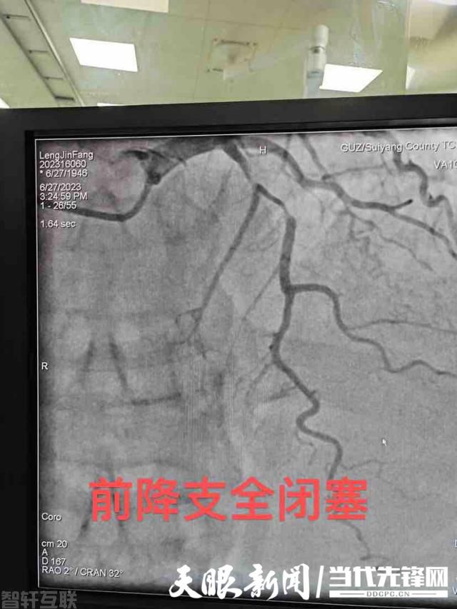  心电一张网：拯救生命的高效救治系统(图2)