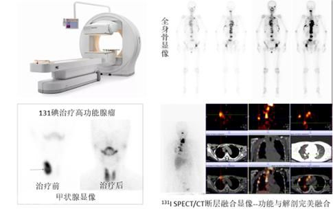  核医学科：揭开医学的神秘面纱(图2)