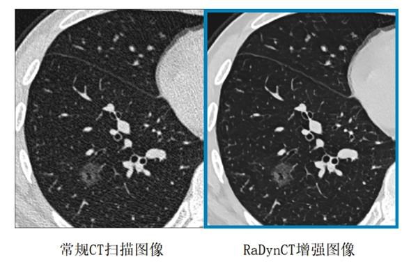  人工智能在医学影像领域的应用(图1)