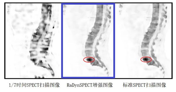  人工智能在医学影像领域的应用(图2)