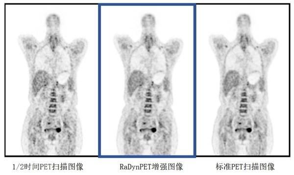  人工智能在医学影像领域的应用(图3)