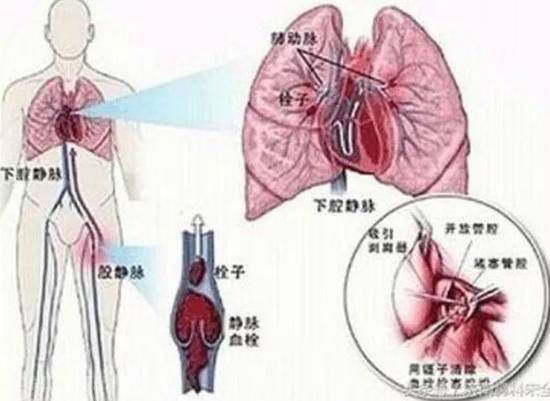  熊孩子角色扮演引发医疗事故，老人生命岌岌可危(图3)