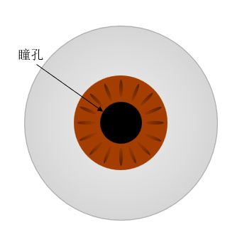  先天性瞳孔残膜与眼部健康(图1)