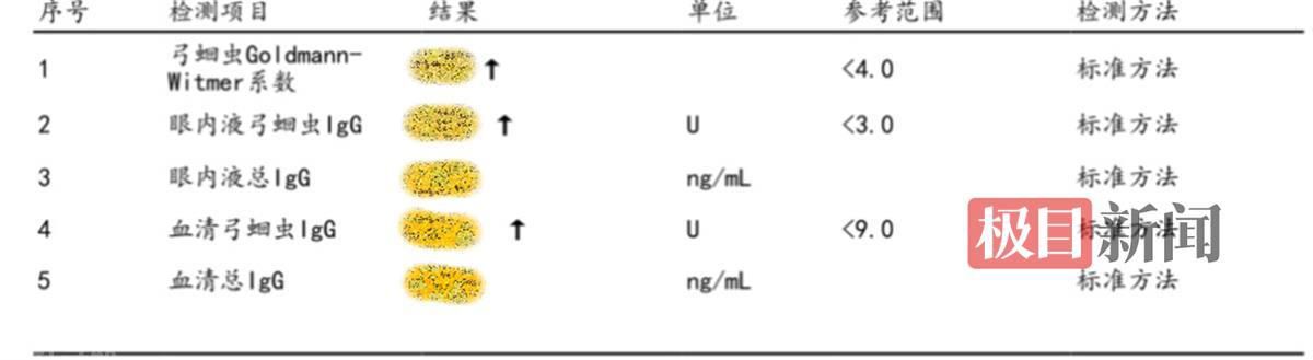  宠物引发的眼弓蛔虫病给孩子带来了视力威胁(图1)