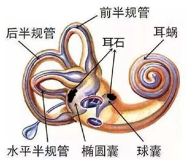  耳石症：让你如醉酒一般的头晕眼花(图1)